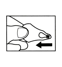 Lee Valley Tick Key Tick Remover